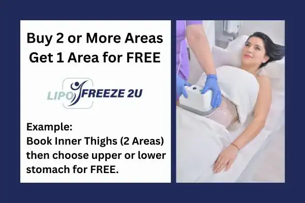 fat freezing prices Kingsbury