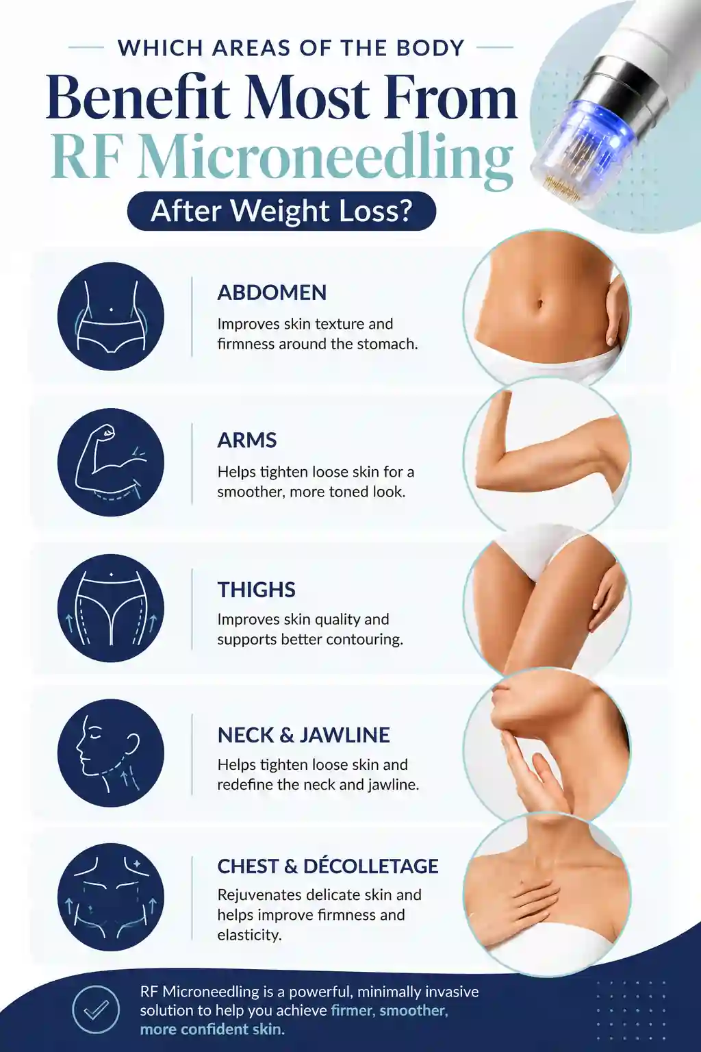 Which Areas of the Body Benefit Most From RF Microneedling After Weight Loss Kingsbury
